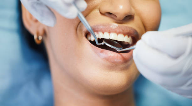 Best Chipped Tooth Repair Near Me  in Cresaptown, MD