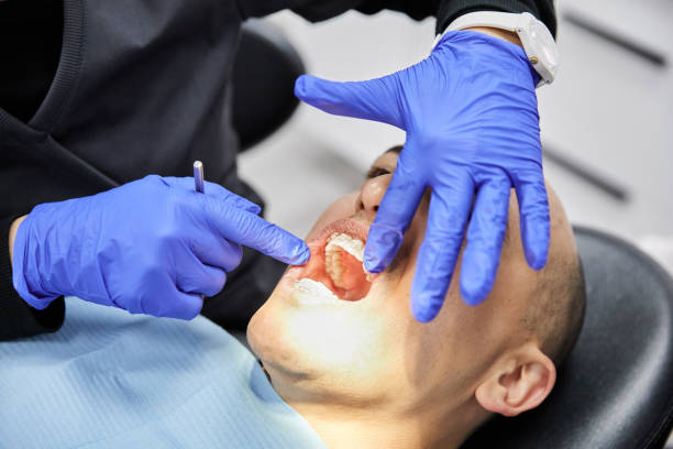 Best Dentist for Tooth Abscess  in Cresaptown, MD